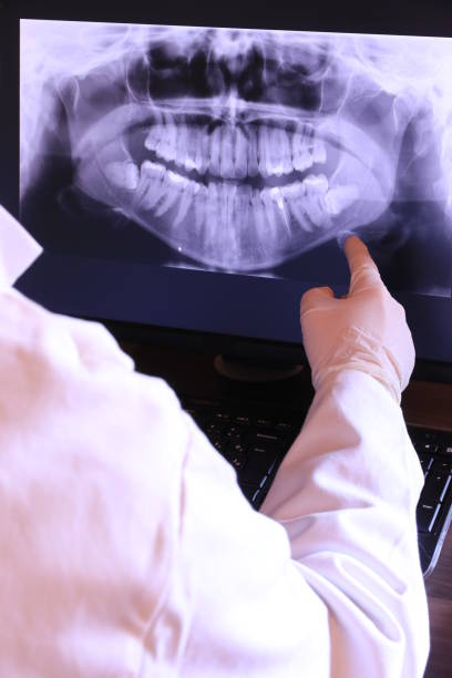 Best Emergency Dental Extractions in Dunbar, SC